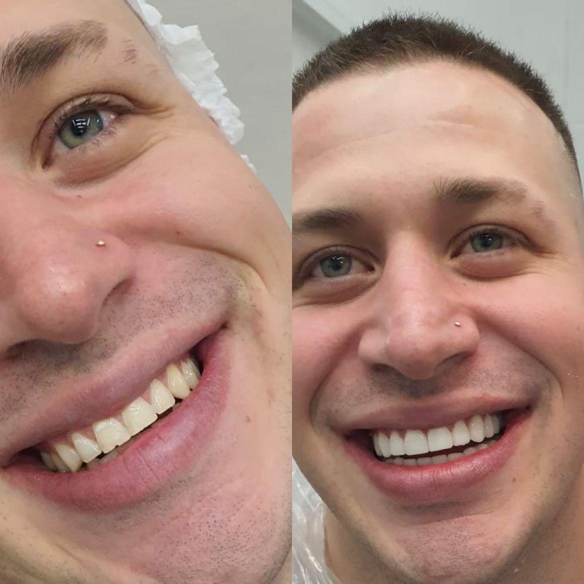 Protocolo Dentário